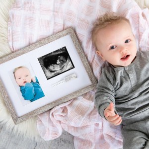 Pearhead: Κορνίζα με φωτογραφία, βραχιόλι ταυτότητας μωρού και φωτογραφία Pearhead: Κορνίζα με φωτογραφία, βραχιόλι ταυτότητας μωρού και φωτογραφία